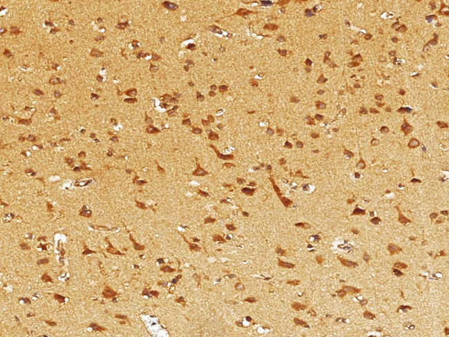 EphB3 Antibody in Immunohistochemistry (Paraffin) (IHC (P))