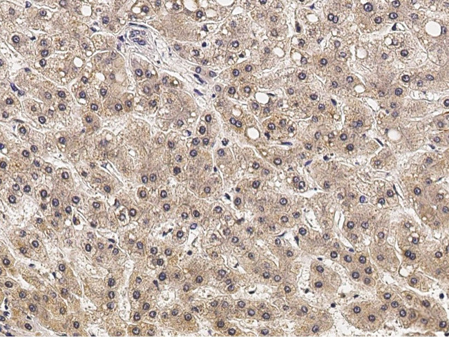 EphB3 Antibody in Immunohistochemistry (Paraffin) (IHC (P))