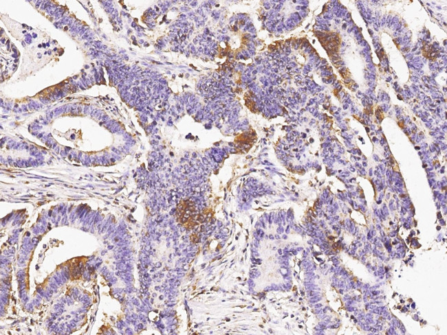 EphB3 Antibody in Immunohistochemistry (Paraffin) (IHC (P))