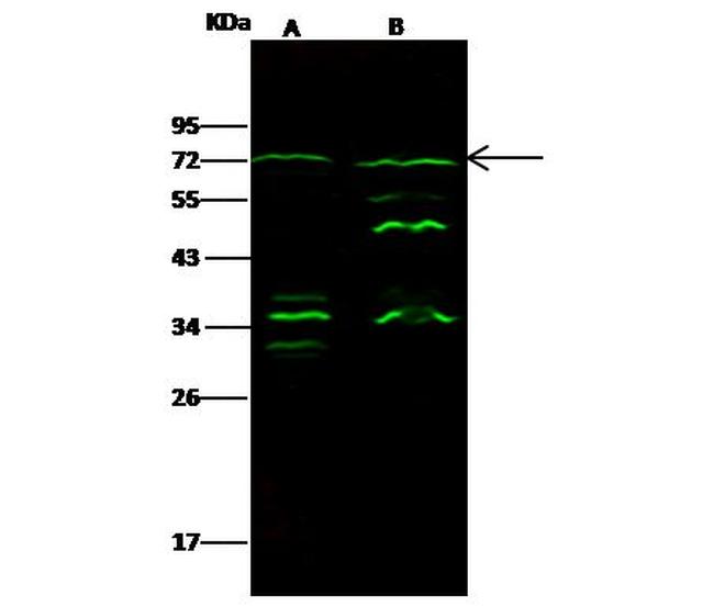 Epsin 3 Antibody in Western Blot (WB)