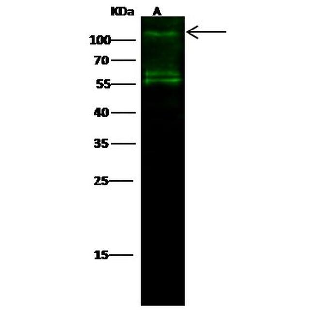 IRE1 alpha Antibody in Western Blot (WB)