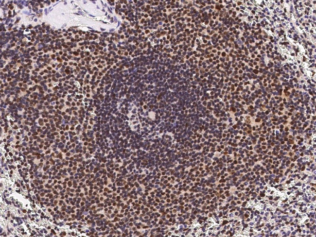 ETV5 Antibody in Immunohistochemistry (Paraffin) (IHC (P))