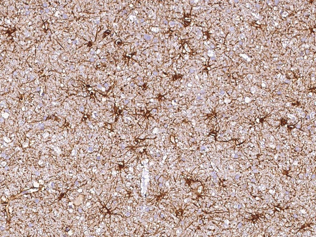 Ezrin Antibody in Immunohistochemistry (Paraffin) (IHC (P))