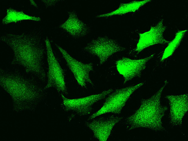 FABP5 Antibody in Immunocytochemistry (ICC/IF)