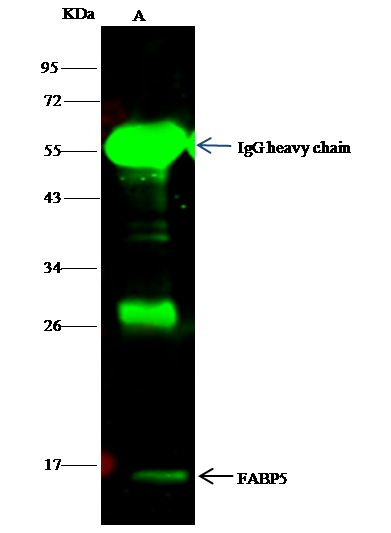 FABP5 Antibody in Immunoprecipitation (IP)