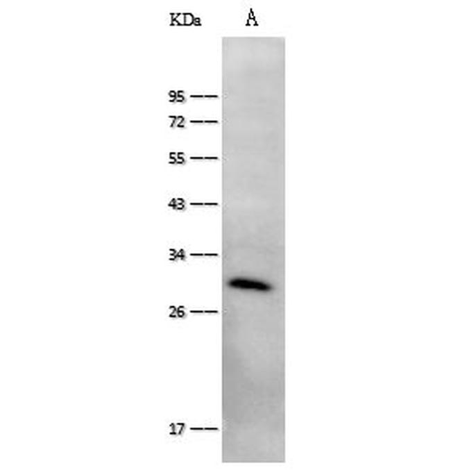 FGF23 Antibody in Western Blot (WB)