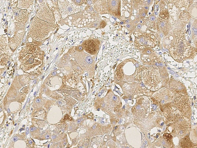 FUT4 Antibody in Immunohistochemistry (Paraffin) (IHC (P))