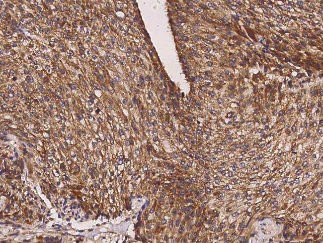 GALE Antibody in Immunohistochemistry (Paraffin) (IHC (P))