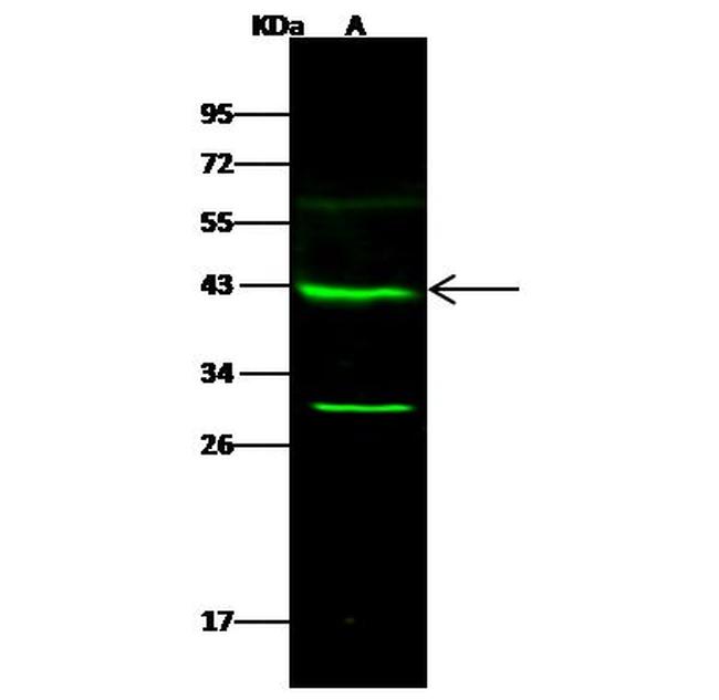 GALK1 Antibody in Western Blot (WB)