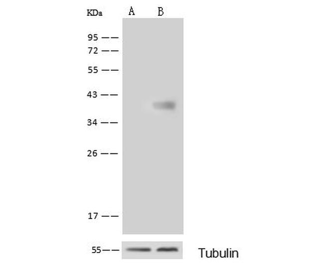 GALK1 Antibody in Western Blot (WB)