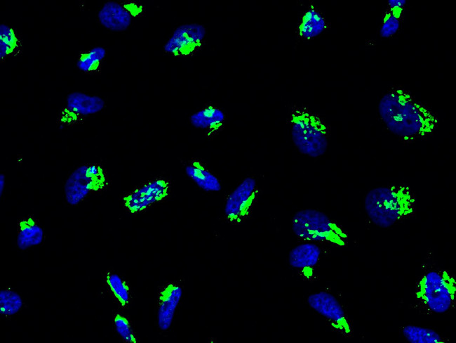 GALNT2 Antibody in Immunocytochemistry (ICC/IF)