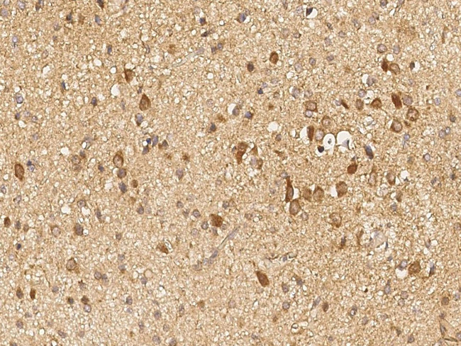 GALNT2 Antibody in Immunohistochemistry (Paraffin) (IHC (P))