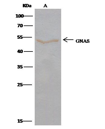 GNAS Antibody in Immunoprecipitation (IP)