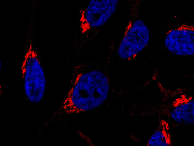 GOLPH2 Antibody in Immunocytochemistry (ICC/IF)