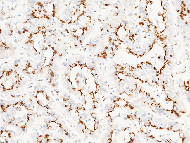 GOLPH2 Antibody in Immunohistochemistry (Paraffin) (IHC (P))