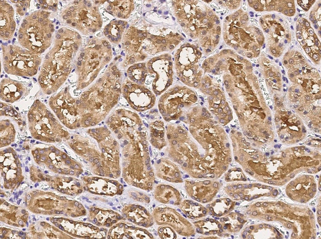 GOT1 Antibody in Immunohistochemistry (Paraffin) (IHC (P))