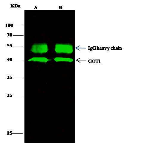 GOT1 Antibody in Immunoprecipitation (IP)