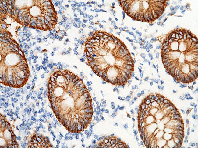 A33 Antibody in Immunohistochemistry (Paraffin) (IHC (P))