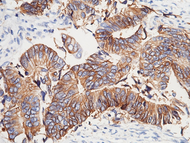 A33 Antibody in Immunohistochemistry (Paraffin) (IHC (P))