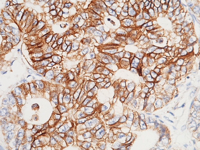 A33 Antibody in Immunohistochemistry (Paraffin) (IHC (P))