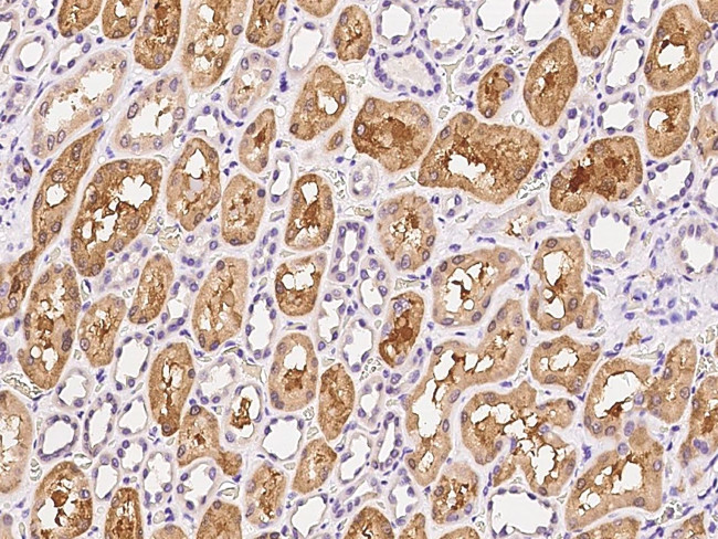 GPD1 Antibody in Immunohistochemistry (Paraffin) (IHC (P))