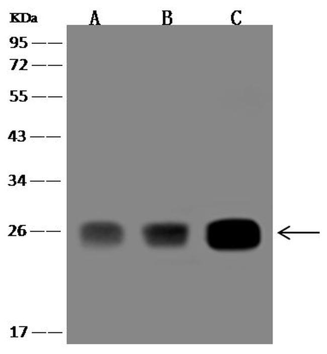 GSTZ1 Antibody in Western Blot (WB)