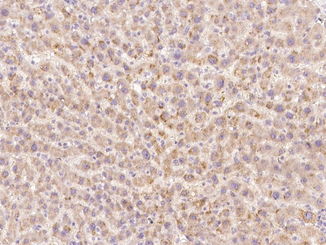 HGF Antibody in Immunohistochemistry (Paraffin) (IHC (P))