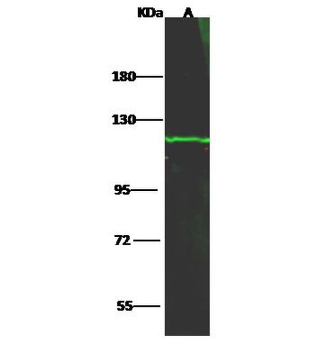 HK1 Antibody in Western Blot (WB)