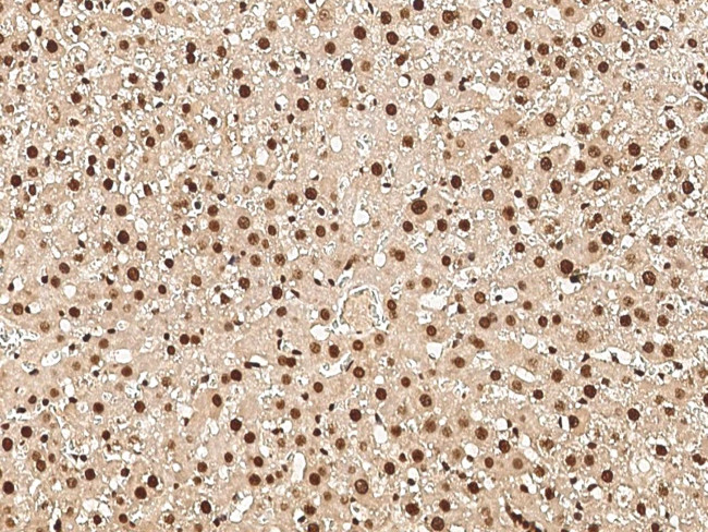 HMGB1 Antibody in Immunohistochemistry (Paraffin) (IHC (P))