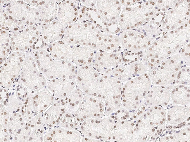 HMGB1 Antibody in Immunohistochemistry (Paraffin) (IHC (P))