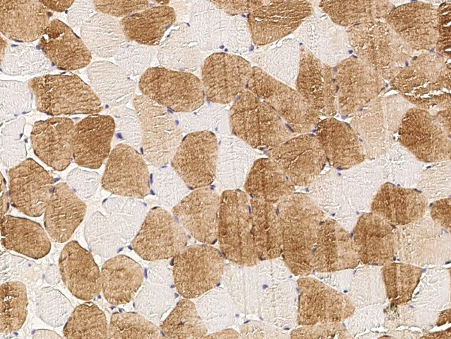 IDI2 Antibody in Immunohistochemistry (Paraffin) (IHC (P))