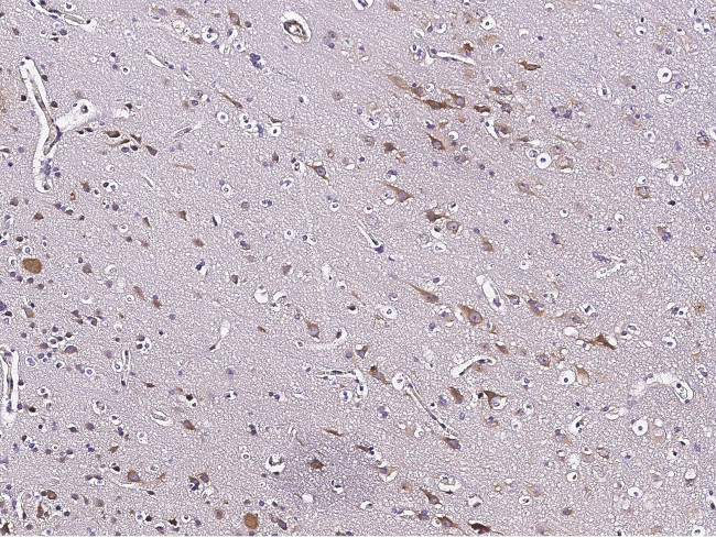 IL18RAP Antibody in Immunohistochemistry (Paraffin) (IHC (P))