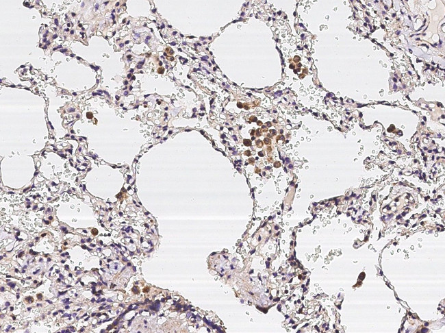 IL18RAP Antibody in Immunohistochemistry (Paraffin) (IHC (P))