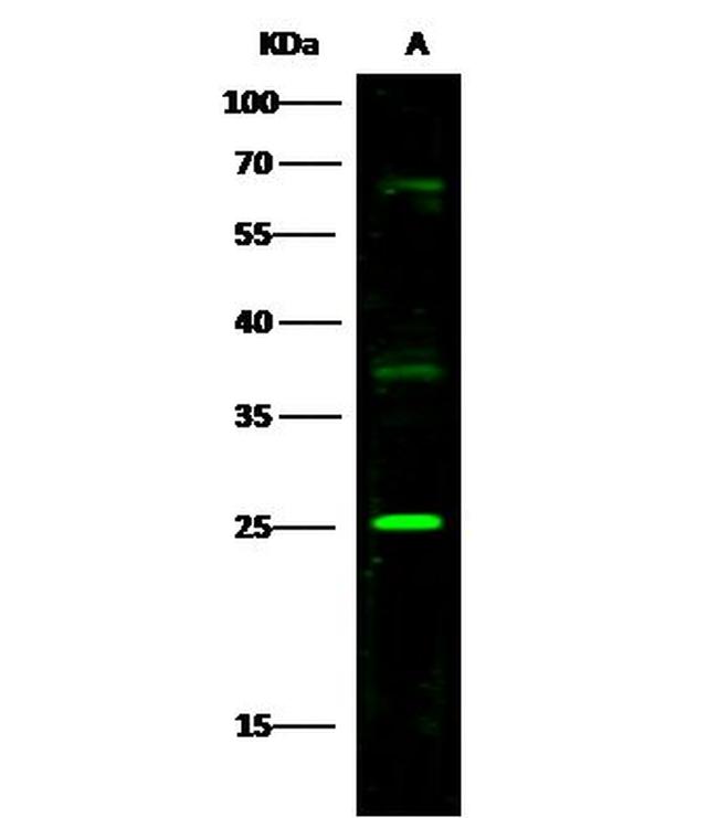 ST2 Antibody in Western Blot (WB)