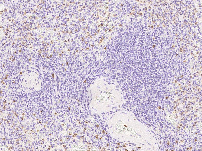 IL21R Antibody in Immunohistochemistry (Paraffin) (IHC (P))