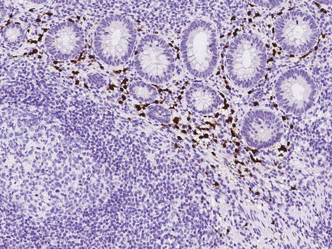 IL2RG Antibody in Immunohistochemistry (Paraffin) (IHC (P))