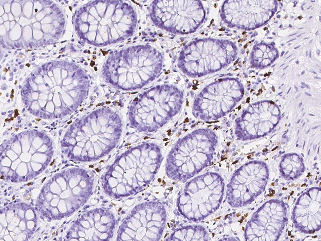 IL2RG Antibody in Immunohistochemistry (Paraffin) (IHC (P))