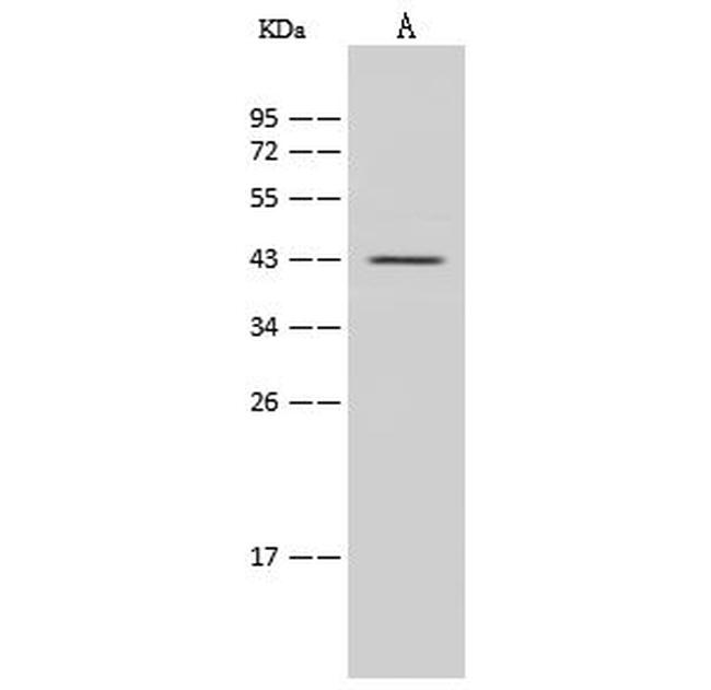 IL2RG Antibody in Western Blot (WB)