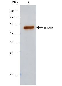 ILKAP Antibody in Immunoprecipitation (IP)