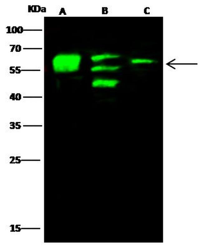 alpha Internexin Antibody in Western Blot (WB)