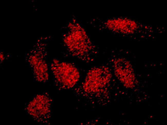 ISL2 Antibody in Immunocytochemistry (ICC/IF)