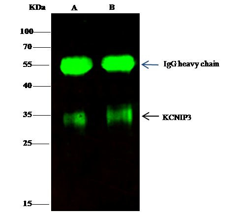 KChIP3 Antibody in Immunoprecipitation (IP)