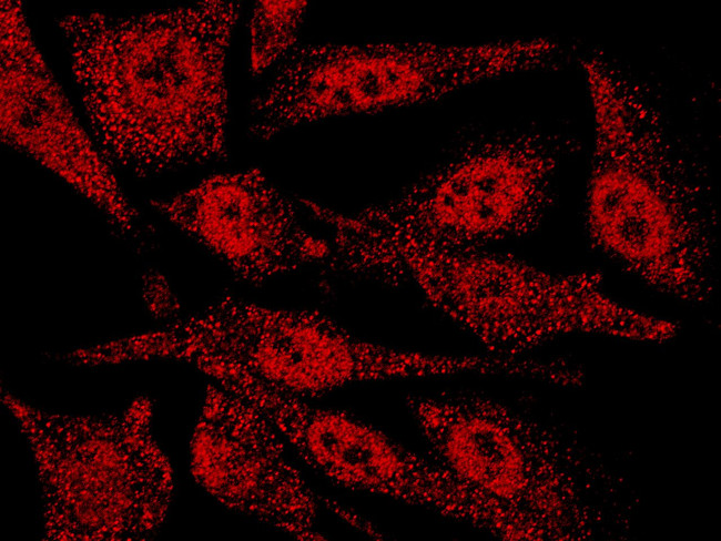 KEAP1 Antibody in Immunocytochemistry (ICC/IF)