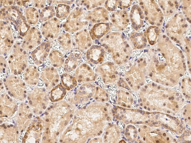 KEAP1 Antibody in Immunohistochemistry (Paraffin) (IHC (P))