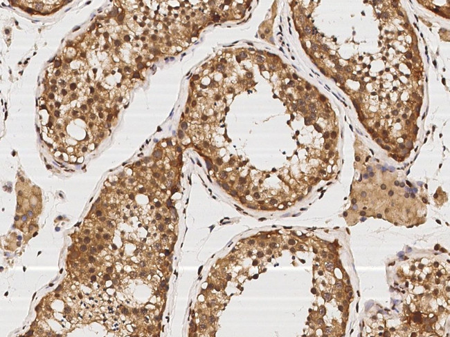 KBP Antibody in Immunohistochemistry (Paraffin) (IHC (P))