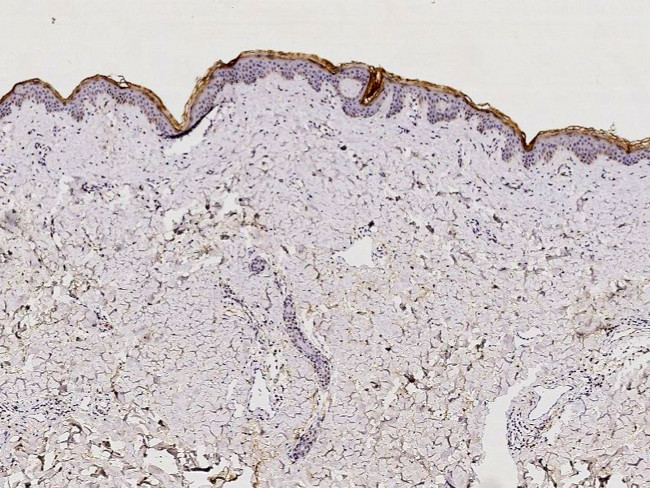 Kallikrein 7 Antibody in Immunohistochemistry (Paraffin) (IHC (P))