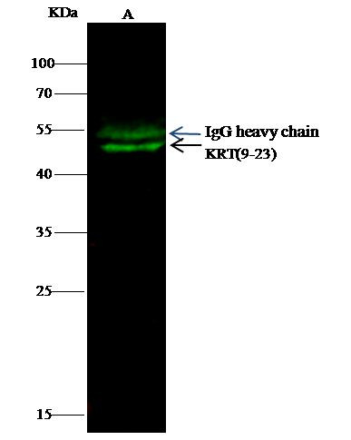 Cytokeratin Pan Type I/II Antibody in Immunoprecipitation (IP)