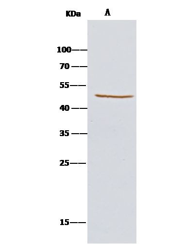 KYNU Antibody in Immunoprecipitation (IP)