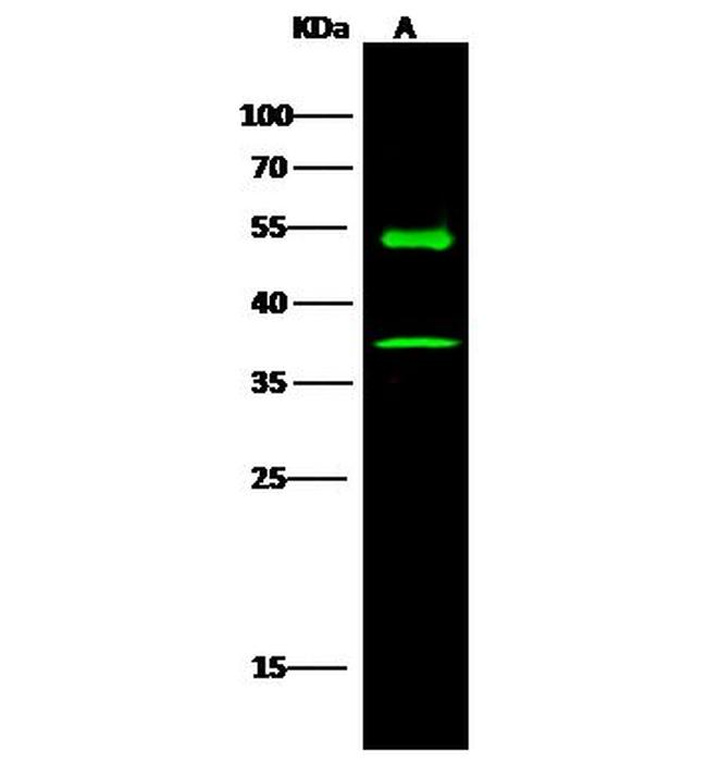 KYNU Antibody in Western Blot (WB)