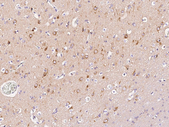 LC3A Antibody in Immunohistochemistry (Paraffin) (IHC (P))